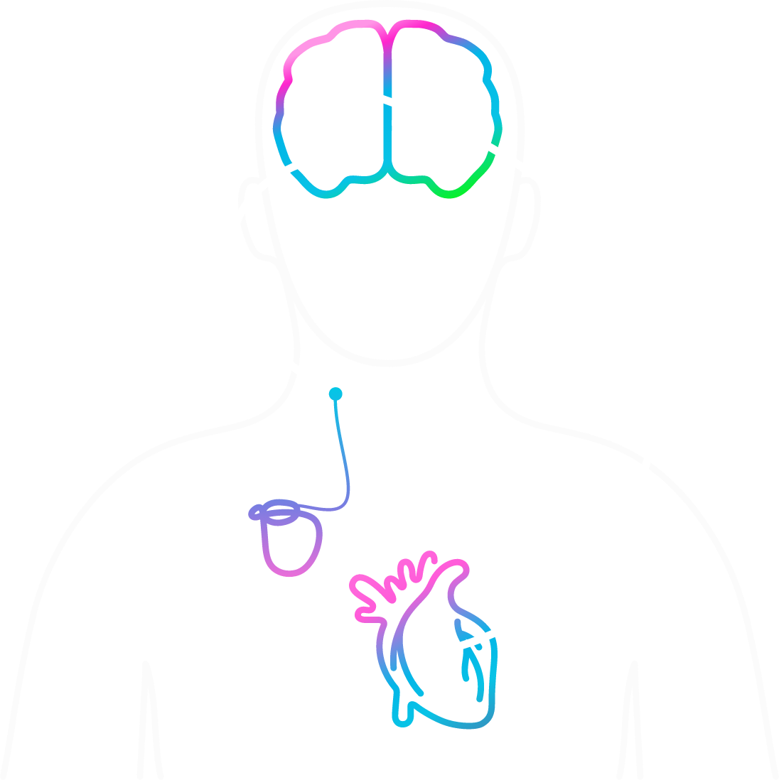 illustration of barostim's baroreflex activation therapy device connecting to the heart and to the brain